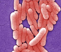 Scanning electron micrograph shows a colony of Salmonella typhimurium bacteria. Photo courtesy of CDC, Janice Haney Carr